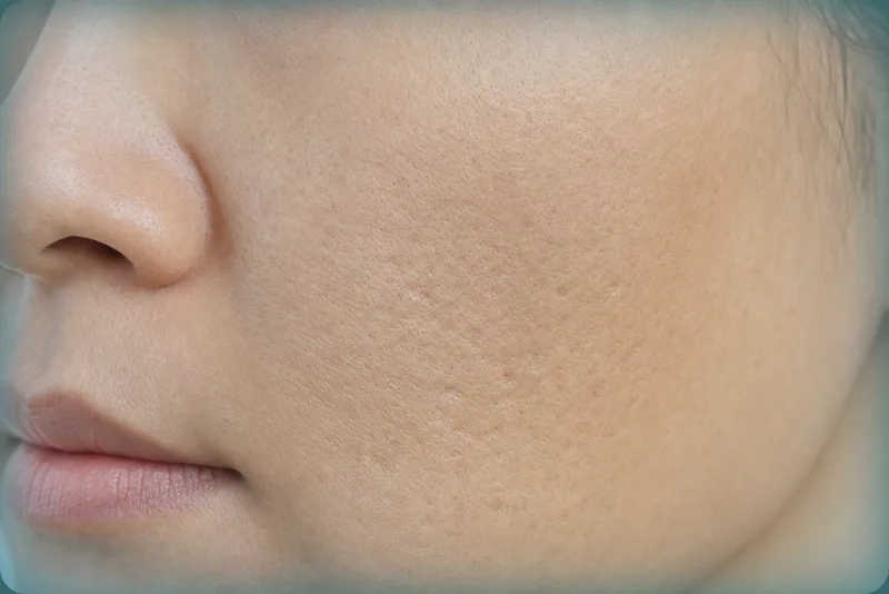 Close view of skin texture, pores, and roughness